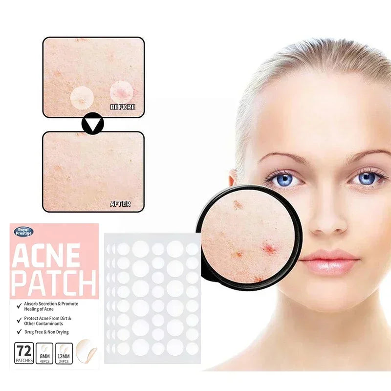 72-360Pcs Invisible + Waterproof Acne Patch Stickers