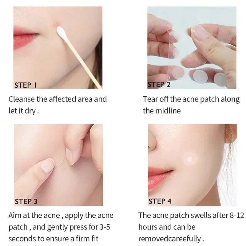 72-360Pcs Invisible + Waterproof Acne Patch Stickers